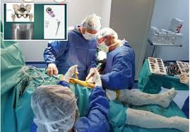 Daca exista nelamuriri sau doriti mai multe detalii nu ezitati sa ne tratamentul cariilor dentare variaza ca si pret in functie de complexitatea fiecareia. Lasa Carja Si Umbla Un Bolnav Scapa De Carje In Timp Record Printr O