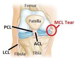 Pin On Injuries