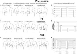 Examples Of Lung Sounds Analysis In 3 Patients One With Pneumonia One Download Scientific Diagram