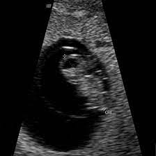 Most women do not know the date they ovulated. Week 7 Ultrasound What It Would Look Like Parents