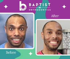 Baptist Orthodontics