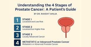 Image result for Prostate Cancer Management