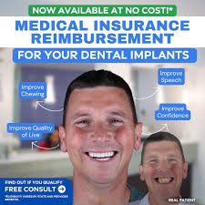 Smart Arches Dental Implants