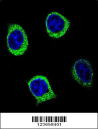 The camel igg elisa is an enzyme immunoassay (elisa) for the quantitative determination of igg 1, 2 and 3 in plasma or serum of the camel. Metabolism Of Carbohydrates Pathway Elisakit Net