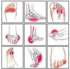 Sharp pain on top of foot area that comes and goes could happen from arthritis, extensor tendonitis, gout, nerve compression, and stress fracture. Foot Pain Symptoms How To Treat Them Foot Pain Explored