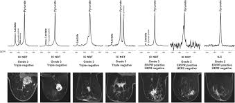 A material object representing something abstract. Imaging Breast Cancer Using Hyperpolarized Carbon 13 Mri Pnas