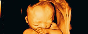 3 D Und 4 D Ultraschall Wahrend Der Schwangerschaft Bitte Kein Babykino Wissen Tagesspiegel