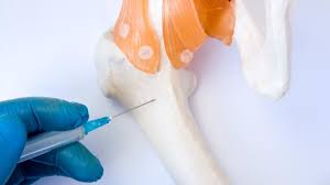When you first hear about a new drug, what would you like to know about it? Bone Cancer 10 Things Doctors Want You To Know