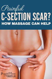 Scar Tissue From C Section Causing Abdominal Pain Years Later Do This