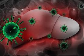 Sebenarnya terdapat 5 virus yang menyebabkan. Hepatitis B Apakah Ia Bagaimana Ia Ditularkan Gejala Dan Rawatan Gejala 2021