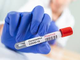 Current vaccines likely still work, scientists say, but their power may be declining. Coronavirus Vaccine Moderna Covid 19 Vaccine Appears To Clear Safety Hurdle In Mouse Study Times Of India