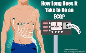 By positioning leads (electrical sensing devices) on the body in standardized locations, health care professionals can learn information about. How Long Does It Take To Do An Ecg