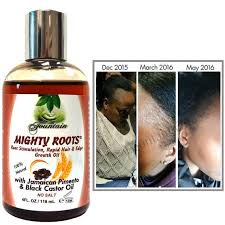 The clear castor oil which we are most familiar with comes from the cold. Buy Organic Edge Growth Vegan Safe Jamaican Black Castor Oil Etsy