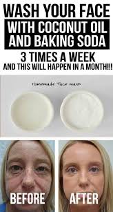 Wash Your Face With Coconut Oil And Baking Soda 3 Times A Week And This Will Happen In A Month Vid Coconut Oil Face Wash Baking Soda Face Wash Oil Face Wash