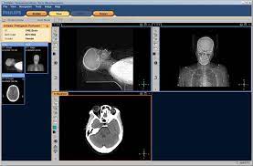 Check spelling or type a new query. Top 25 Free Dicom Viewers For Doctors Medical Students And Health Professionals Postdicom
