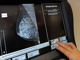 Radiolexikon Gesundheit Mammografie Archiv