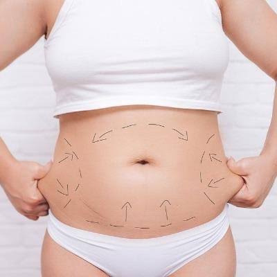 Non Surgical Fat Reduction in Islamabad - Enfield Royal Clinics