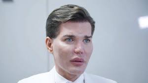 Rodrigo alves hat nur einen einzigen wunsch: Nase Von Briten Ken Kaputt Meine Prioritat Ist Mein Aussehen News Inland Bild De