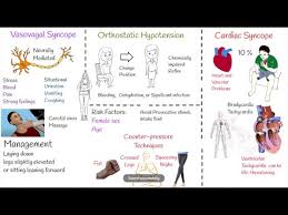 Image result for Exercise Induced Syncope