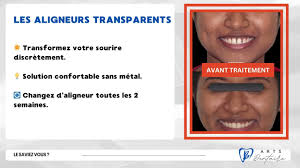 Case Near Me Applying Dental Wax To Invisalign At James Ivery Blog Armoire  Dressing