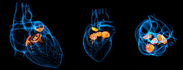 Tct 2021 Medtronic And Edwards Target Hard To Reach Valves Evaluate