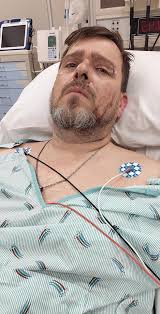 Guys i have quick question: the flat bottom steering wheel have same airbag  like standard steering wheel from vw CC 2gen?