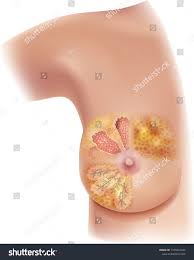 Pin On Female Body Anatomy