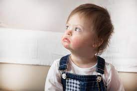 Every person born with down syndrome is different. Zur Debatte Um Vorgeburtliche Tests Auf Das Down Syndrom