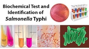 Salmonella infection (salmonellosis) is a common bacterial disease that affects the intestinal tract. Biochemical Test And Identification Of Salmonella Typhi