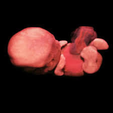 We did not find results for: Parentune 8 Weeks And 5 Days Pregnant Baby Fetal Progress Ultrasound Nutrition Tips And Advice