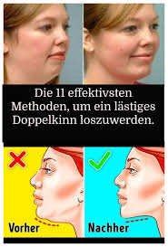 Die 11 Effektivsten Methoden Um Ein Lastiges Doppelkinn Loszuwerden Double Chin Skin Health Daily Health Tips