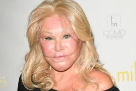 You had better sit down before you see her in the archival photos!  🫢😵‍💫Only few have seen the fashion icon before she got a «new face»  after multiple plastic surgeries! 🧐🤯Seeing what