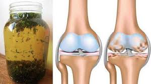 Remedio Rodillas Png 640 360 Pixeles Healthy Tips Health Remedies Natural Medicine