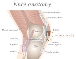 1,10,12,28,30,46,66,81 these studies assessed patellofemoral pain in general. Jumper S Knee Symptoms In Kids Jumper S Knee Treatment