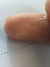The white bulb remains underneath this and cannot be wiped off or detached from the hair strand, its is a part of the hair, they are one unit. Why Does My Hair Comes Out With The White Bulb Thingy Each Time I Scratch My Scalp I Can Feel These White Bulb And When I Scratch Them Out With My Nails It
