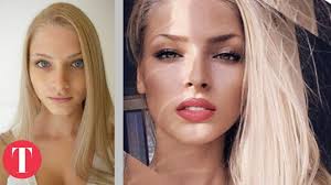 10 Hot Instagram Stars Before Plastic Surgery Plastic Surgery Beauty Surgery