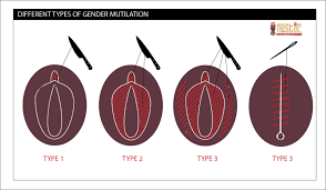 Fgm is one standard procedure. What Do You Know About Female Genital Mutilation