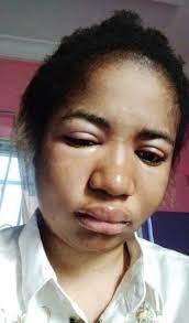 Eh eh eh eh… like you walked through the streets of galilee resp: Comedienne Ada Jesus Allegedly Rushed To Hospital Diagnosed With Kidney Problem Photos Video Infozer