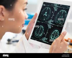 Mid brain hi-res stock photography and images