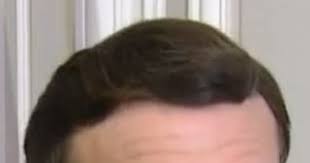 La levée de cette restriction, en vigueur depuis le 9 juin à 23h00 mais démarrée depuis le mois d'octobre à un horaire plus précoce, s'appliquera donc à la fête de la musique du 21 juin, même si les autres. Moumoute Et Deux Alliances De Macron Les Curieuses Requetes Des Internautes Breakflip Awe Vous Avez Une Question On A La Reponse