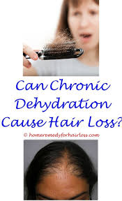 Many drugs (like synthroid) for regulating thyroid cause hair loss as well. Pin On Hair Loss Remedy