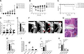 Use the same product spetic helper 2000 looking to aquire more but must be discontinued down to my last 3 bags. A Novel Mouse Model For Septic Arthritis Induced By Pseudomonas Aeruginosa Scientific Reports