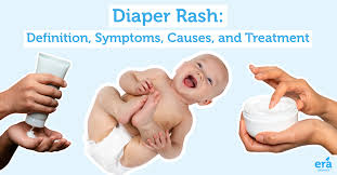 Image result for diaper dermatitis