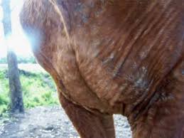 Image result for Anhidrosis