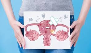Genetic defects found on brca1 and brca 2 can dramatically increase. Uterine Cancer What Are The Risk Factors The Care Issue
