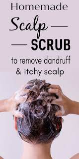 Most Effective Home Remedies To Get Rid Of Dandruff Dry Scalp Treatment Diy Scalp Scrub Dry Scalp Treatment