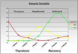 subacute thyroiditis endotext ncbi bookshelf