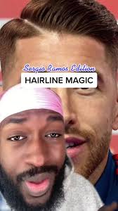 Sergio Hairline