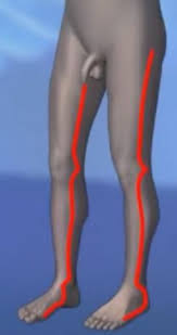 Occasionally, with severe burns this may occur early during the resuscitation period requiring escharotomy in the emergency department or during transport. Escharotomy Wikem