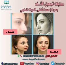 تجربتي في عملية تجميل الانف في تركيا تجربتي مع تجميل الأنف في تركيا